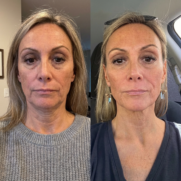 PureOne Face Wrap Rezultate